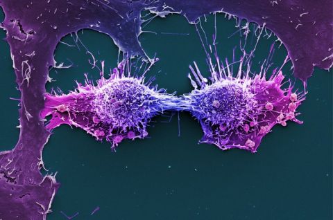 The HeLa line of immortal human epithelial cancer cells was derived from cells taken from Henrietta Lacks when she was a cancer patient in 1951. (Wellcome Collection: Anne Weston, Francis Crick Institute), CC BY-NC